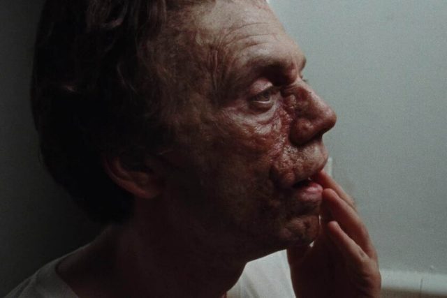 "Un uomo diverso" (2024), recensione | Una straordinaria commedia surreale